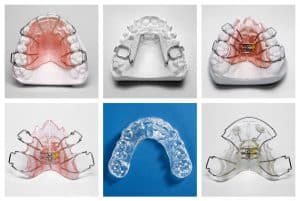 Orthodontic_Appliances