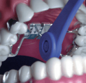 Expander_Key