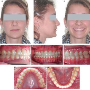 Orthodontic_Photographs-1