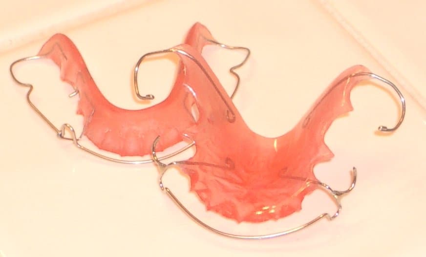 My_Retainers